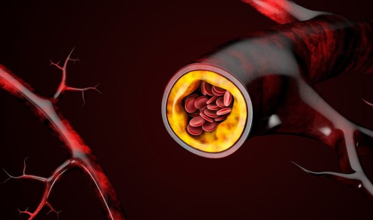 Cholesterol Ldl Taux A Ne Pas Depasser
